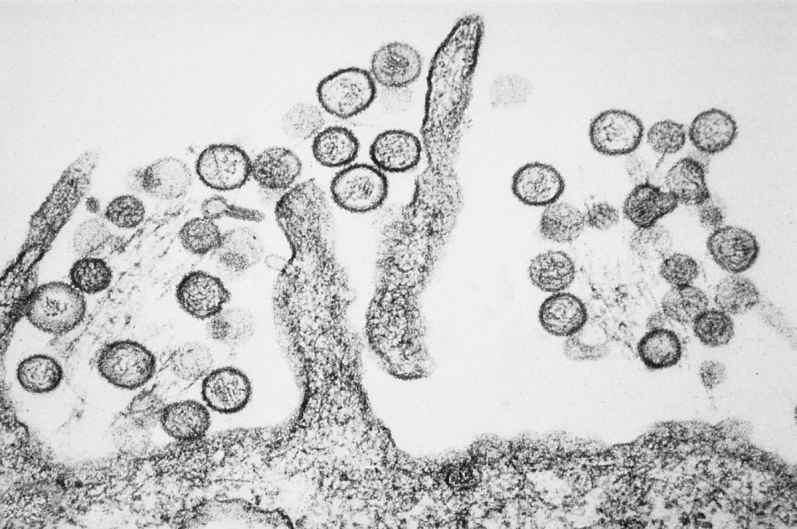US Patient with Hantavirus Symptoms Tests Negative