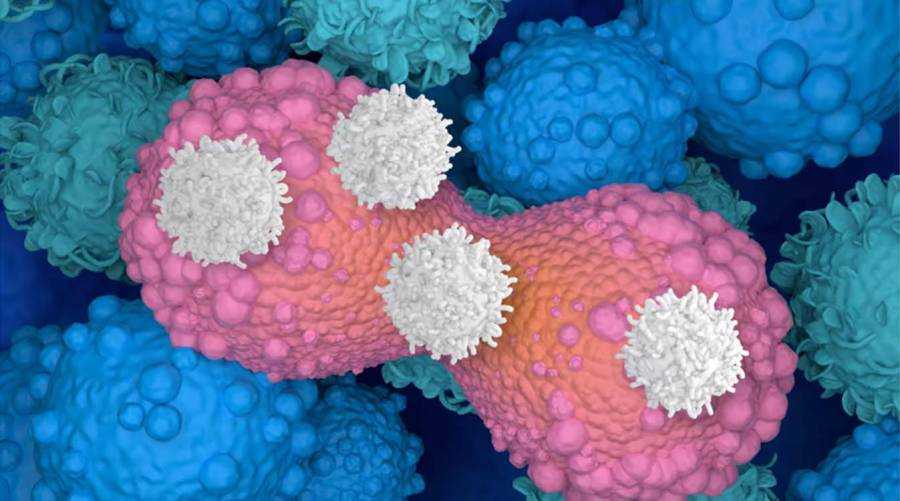 Game-changer CAR T-cell therapy shows stunning cancer remission in global trials