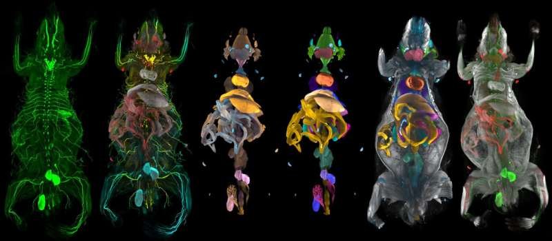 AI Atlas Reveals Hidden Whole-Body Damage Caused by Obesity