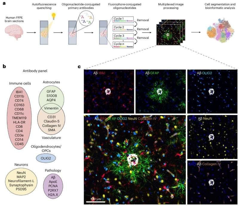 New Technique Reveals Hidden Immune Cell Population in Alzheimer’s Brains