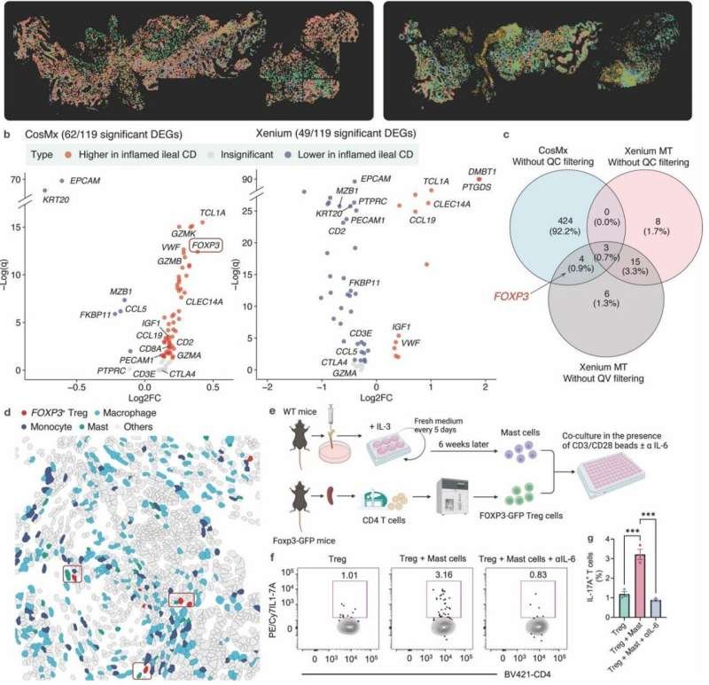 Spatial Transcriptomics Atlas Enhances Understanding of Inflammatory Bowel Diseases