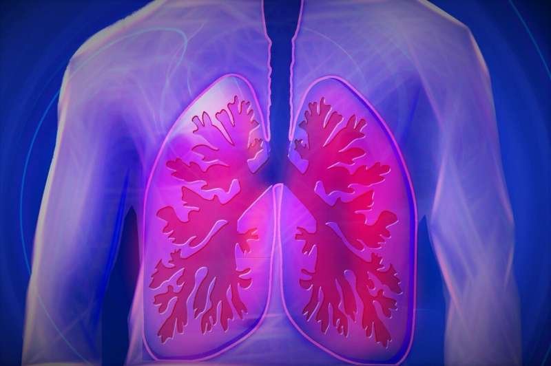 Study Finds Private Equity-Owned Hospitals Have Poorer Outcomes for Lung Conditions