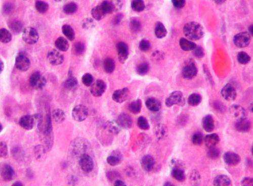 Teclistamab Extends Remission in Relapsed Myeloma with 70% Progression-Free Survival at 18 Months