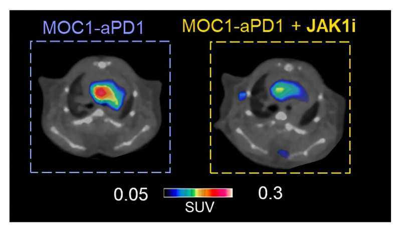 Dual PET imaging detects tumor progression and heart inflammation during cancer treatment