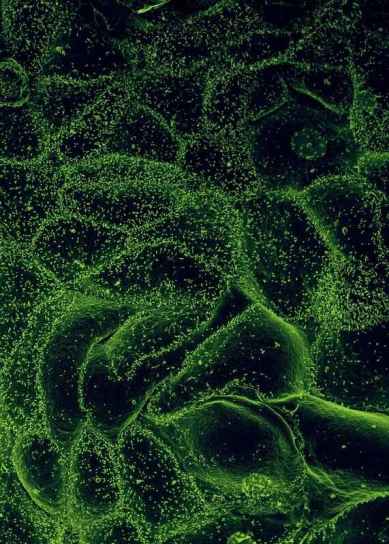 We need to act now: Race to Develop Ebola Vaccine Heats Up