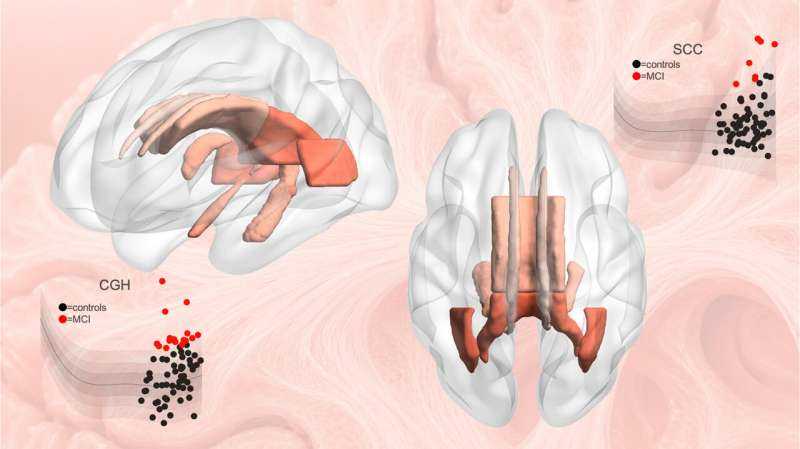 Brain 'Growth Charts' Map White Matter Changes Across Human Lifespan