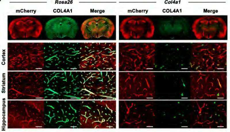 CRISPR Model Links Faulty Collagen to Brain Microbleeds Tied to Memory Decline