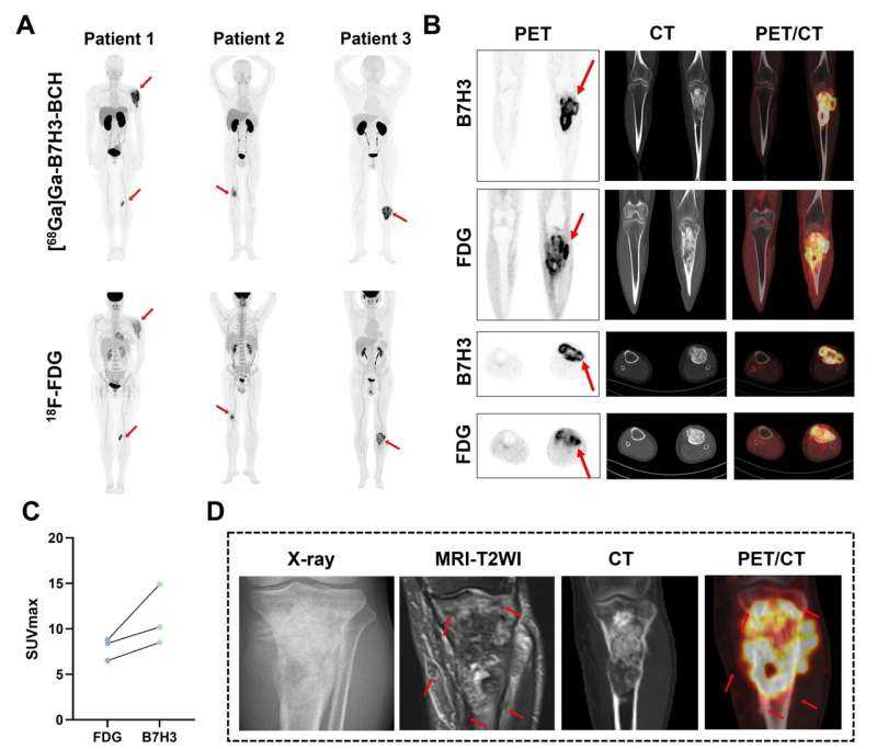 Integrated PET imaging platform rapidly defines clear margins to guide surgical resection in osteosarcoma
