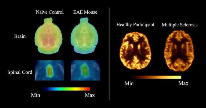 PET imaging reveals synaptic loss in multiple sclerosis across preclinical and human studies
