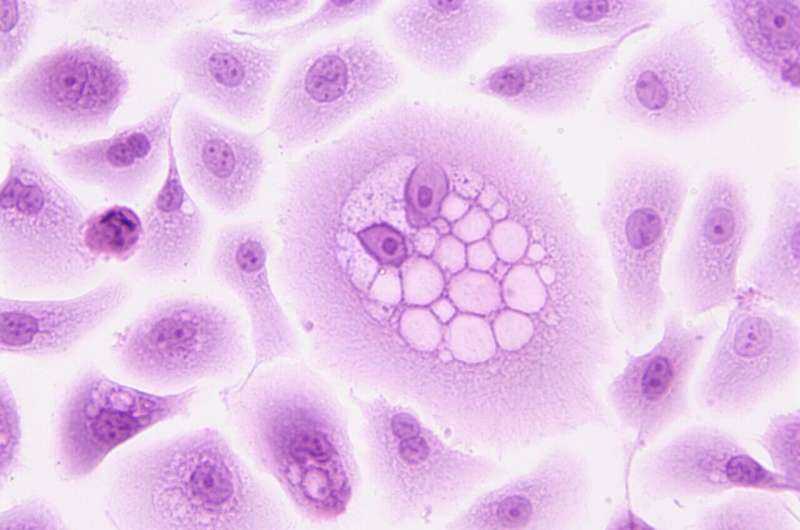 Cancer Researchers Present Advances and Emerging Treatments