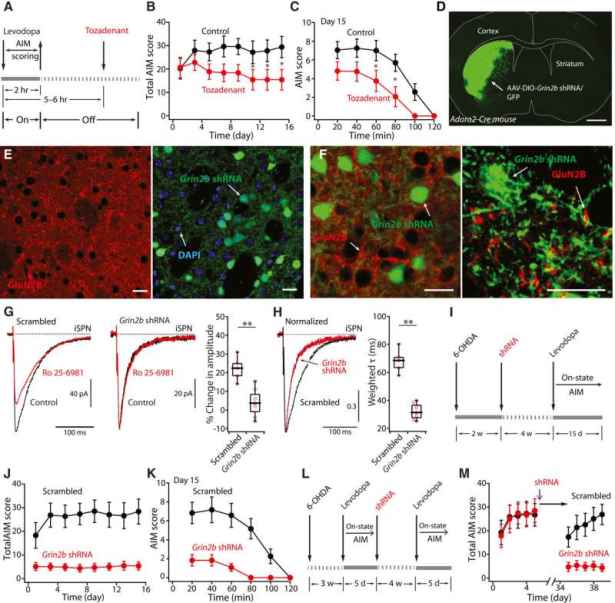 Potential Gene Therapy for Late-Stage Parkinson’s Side-Effects Uncovered